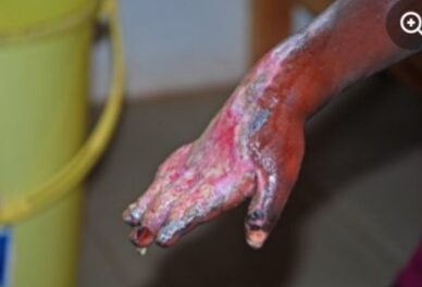 Centrafrique : quand la faim d’un enfant de 4 ans devient un crime familial