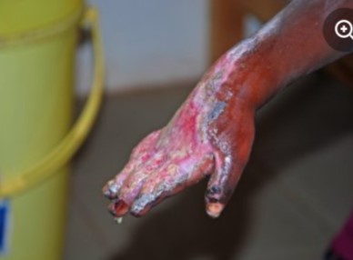 Centrafrique : quand la faim d’un enfant de 4 ans devient un crime familial