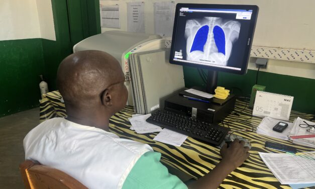 Centrafrique : Loin de Bangui, l’IA aide à dépister la tuberculose 